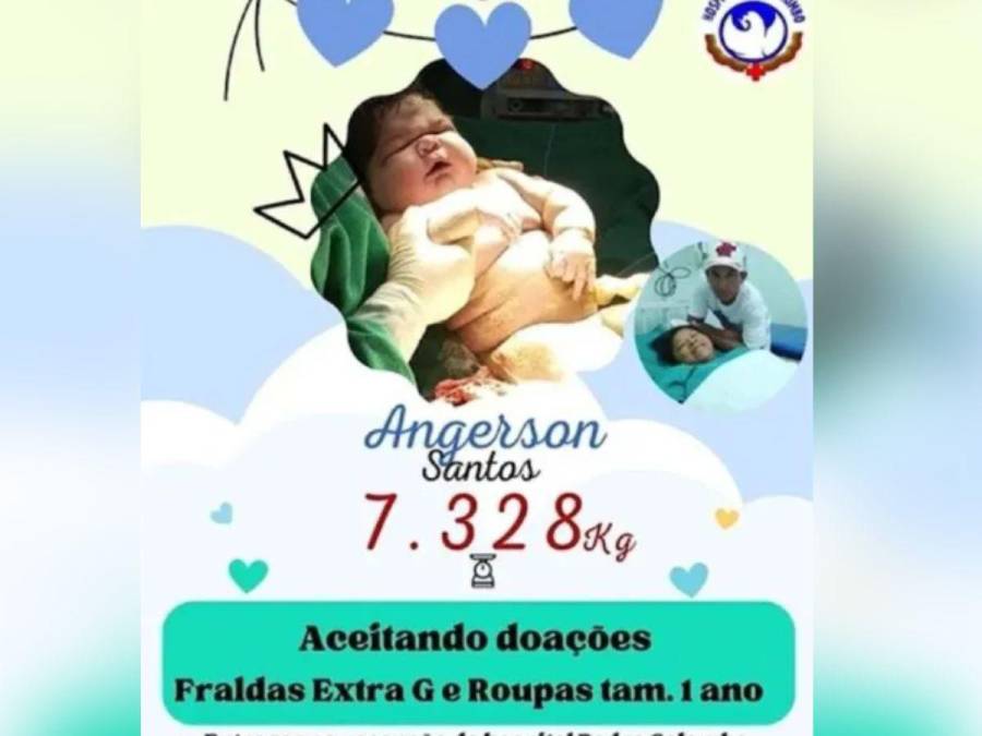 Pesó 16 libras y midió 59 centímetros: así es Angerson, el bebé brasileño más pesado del mundo