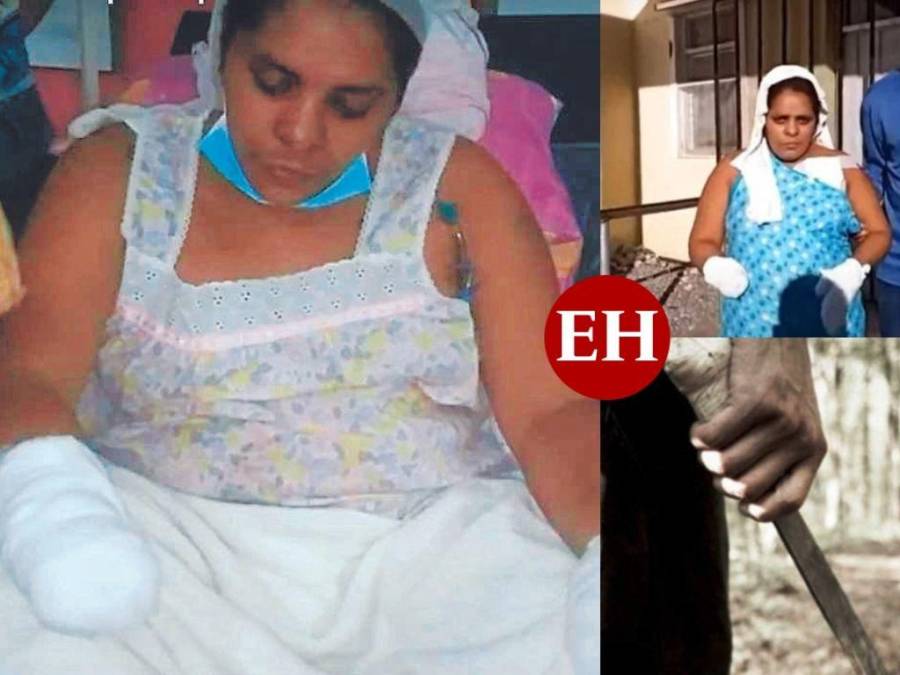 ¡Horror! Hombre le corta las manos a mujer que no le hizo caso en Choluteca