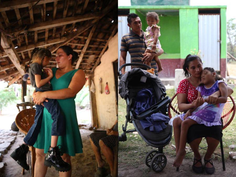 Los hijos del zika sobreviven en medio de la calamidad: las historias no contadas