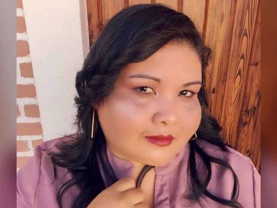 ¿Fue por extracción de muela? Revelan las causas de muerte de la hondureña Cristina Lagos en Hospital del Sur