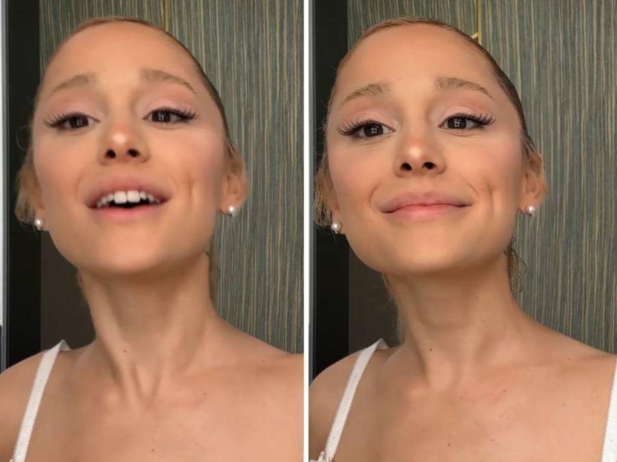 Evolución facial de Ariana Grande: la cantante reconoció haberse inyectado “una tonelada” de relleno de labios y bótox