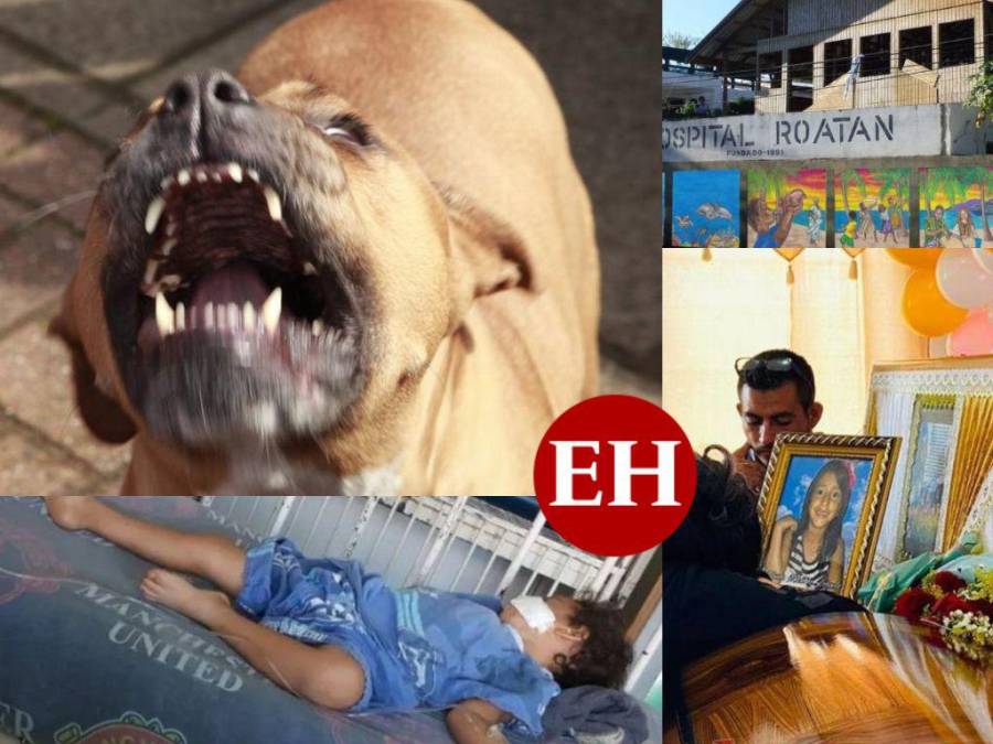 Niños desfigurados y otros muertos, los más recientes ataques de perros pitbull que dividen opiniones en Honduras