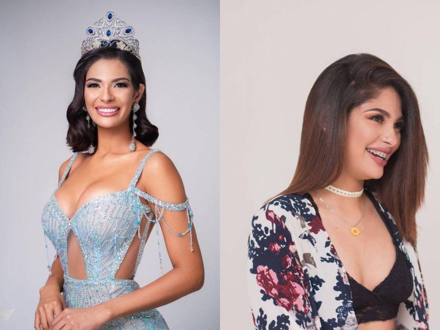 ¿Cuáles son las cirugías plásticas de Miss Universo, Sheynnis Palacios?