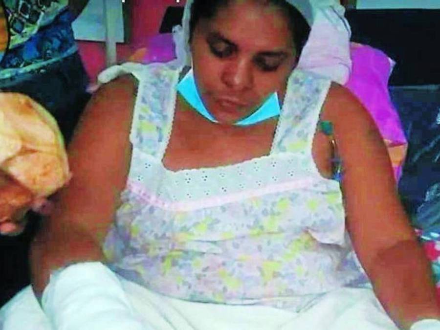 ¡Horror! Hombre le corta las manos a mujer que no le hizo caso en Choluteca