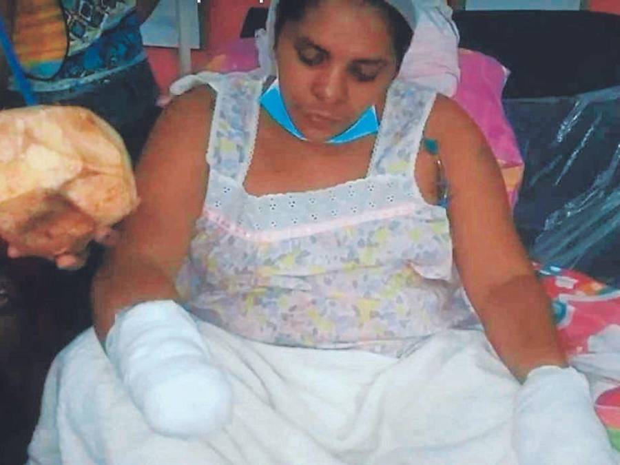¡Horror! Hombre le corta las manos a mujer que no le hizo caso en Choluteca