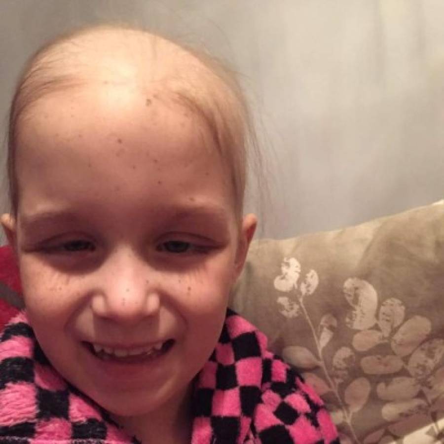 La última pestaña de una niña que lucha contra el cáncer conmueve al mundo   