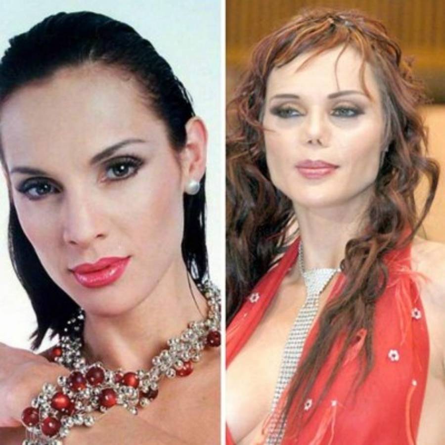 Famosos que lucen terribles después de las cirugías