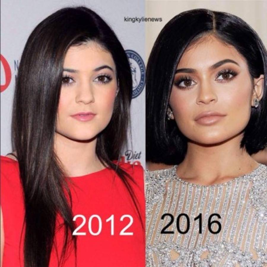 ¡Al descubierto! Cirujano plástico de Kylie Jenner destapa todas las cirugías que se realizó la modelo