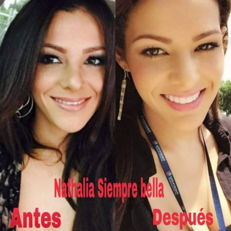 Nathalia Casco luce nueva sonrisa