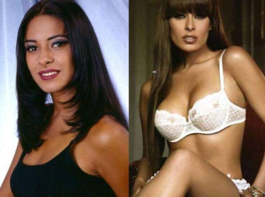 Antes y después: así lucen varias famosas mexicanas después de las cirugías