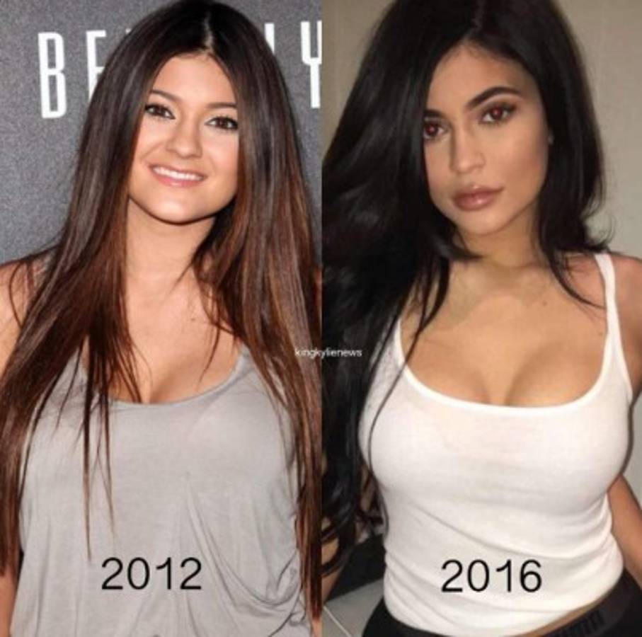 En las redes circulan imágenes comparativas de la celebridad. Foto Instagram