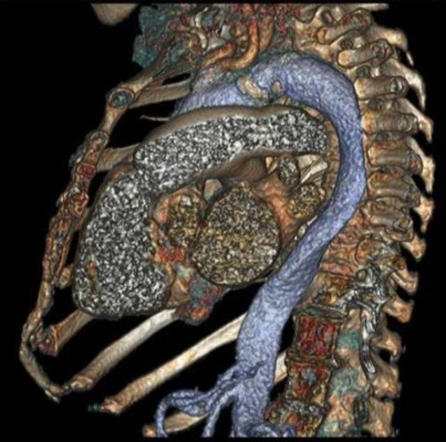 El cuerpo humano por dentro como nunca lo has visto