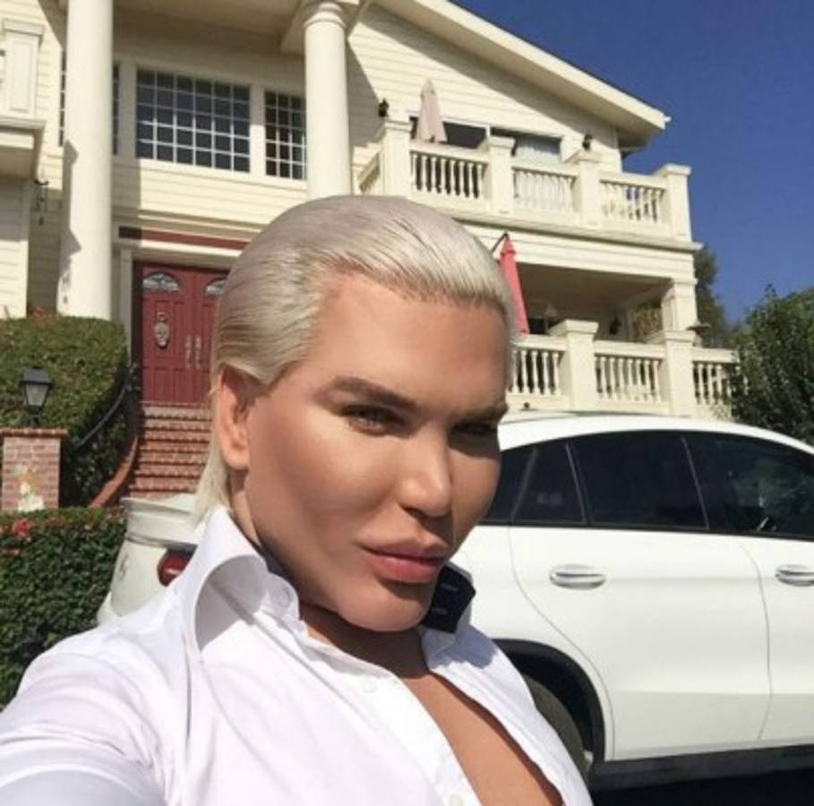 La controversial cirugía 190 del 'ken humano' brasileño ¿qué se hizo ahora?