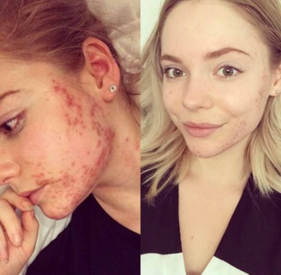 Decidió cambiar su dieta y empezó a publicar su rutina en su perfil de Instagram. Foto Instagram @asprinkleofhealthandbeauty