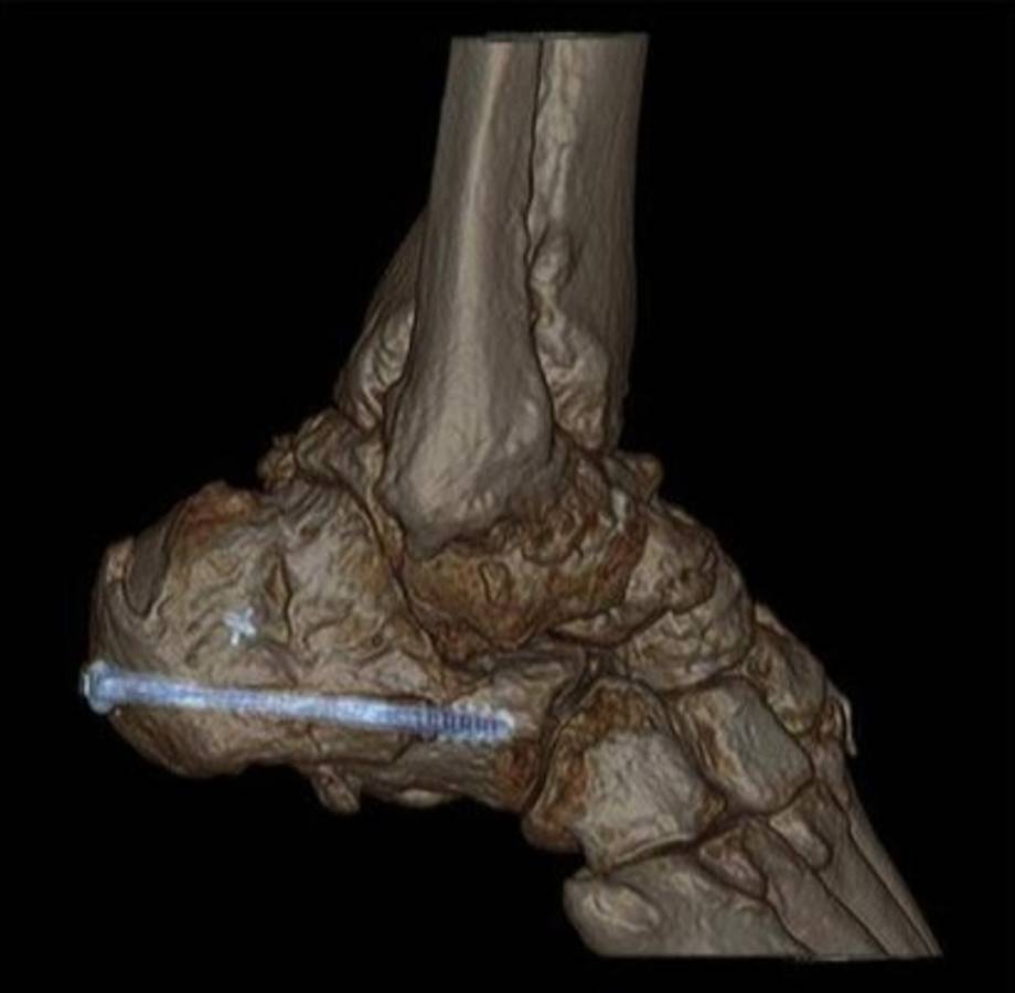 El cuerpo humano por dentro como nunca lo has visto
