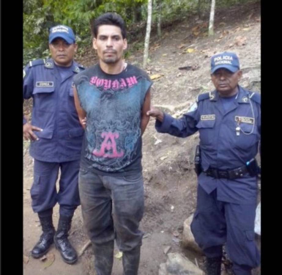 Salvaje marido le cercena los pies a compañera de hogar