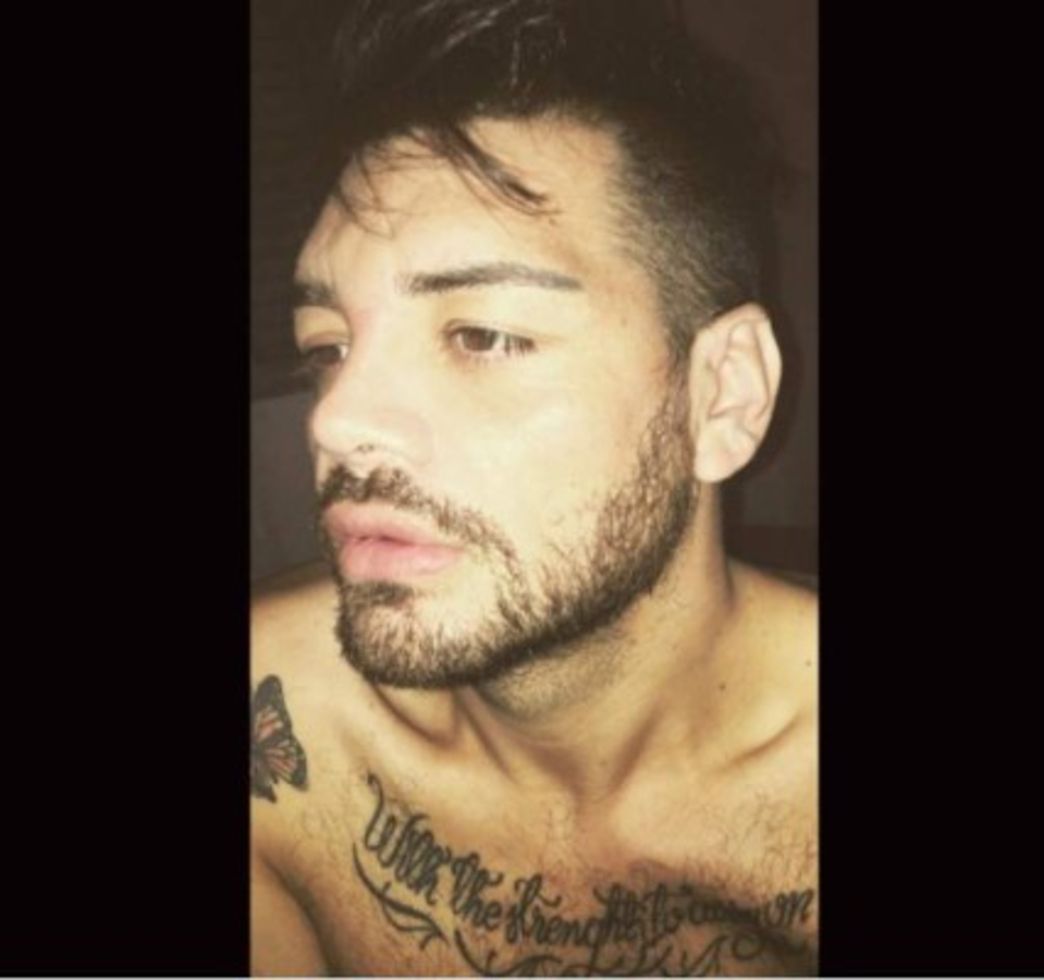 FOTOS: El hombre que se operó para parecerse a Ricky Martin