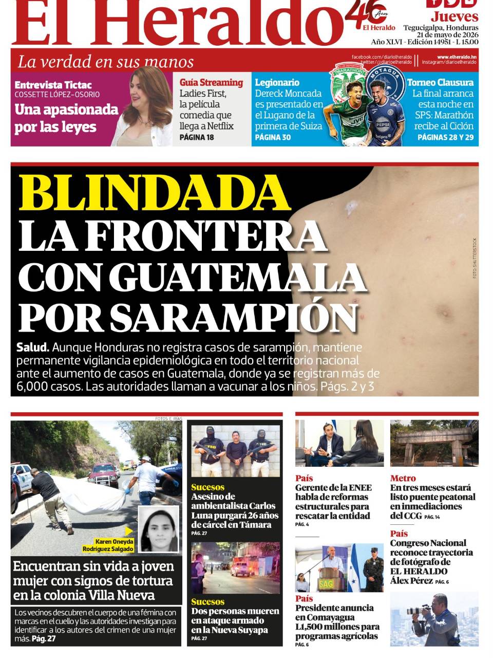 Blindada la frontera con Guatemala por sarampión
