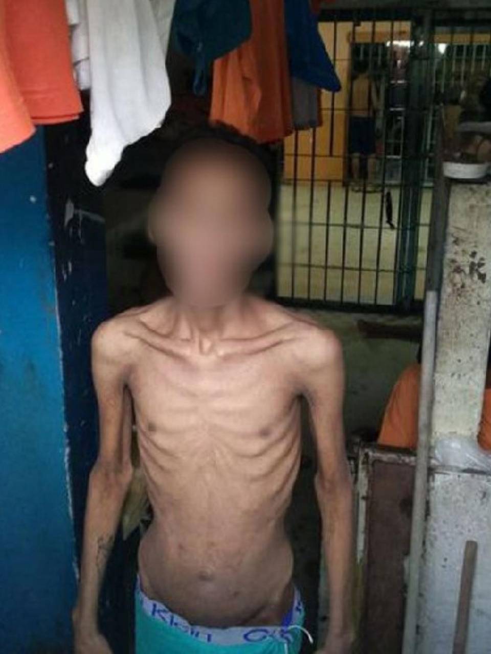 Esta imagen corresponde a uno de los privados de libertad en cárceles de Ecuador, donde se está imponiendo el hambre que ocasiona una crisis humanitaria.