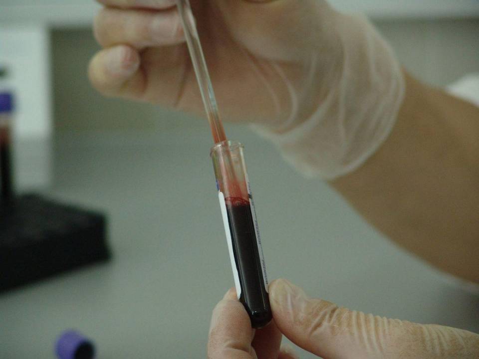 Imagen representativa de una muestra de sangre para análisis clínico.