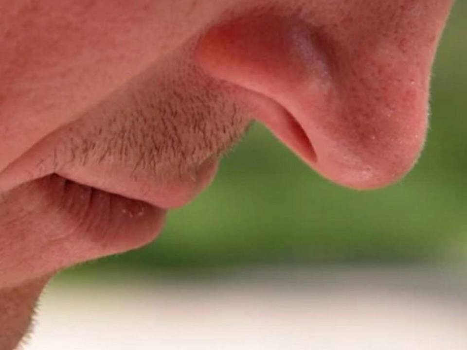 Hay pacientes que adquieren la infección por el coronavirus y sufren la pérdida del olfato aun sin sentir congestión de la nariz.