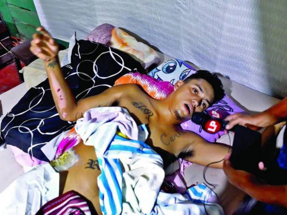 El joven Ariel Girón Rodríguez se encuentra postrado en su cama.