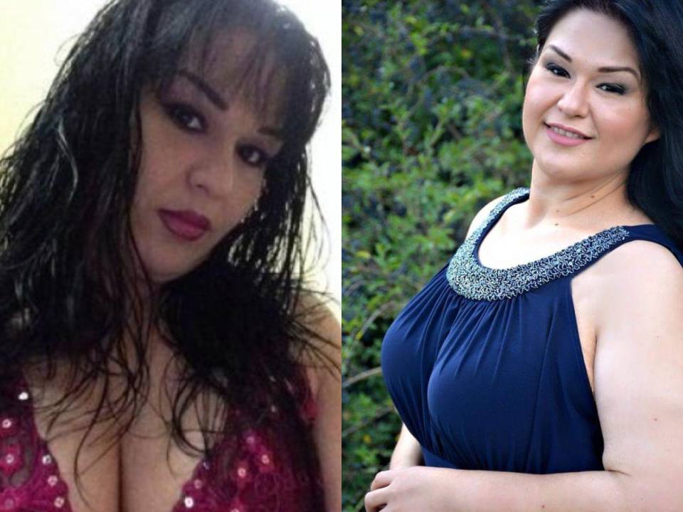 Mayra Rosales fue conocida por años como la mujer más obesa del mundo por pesar media tonelada. Actualmente la famosa mujer ha bajado increíblemente de peso y vive una vida saludable al lado de su esposo.