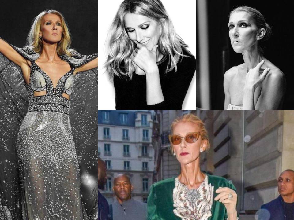 En diciembre de 2022 Celine Dion<b> </b>sorprendió a todos sus seguidores desvelando que padece una enfermedad que afecta a una persona de cada millón: el síndrome de la persona rígida, ¿qué es ese padecimiento y por qué pone en riesgo su vida?