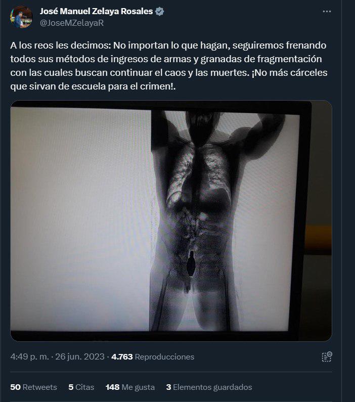 $!¿Esta foto de un reo con una granada en el recto corresponde a los operativos en la cárcel de Támara?